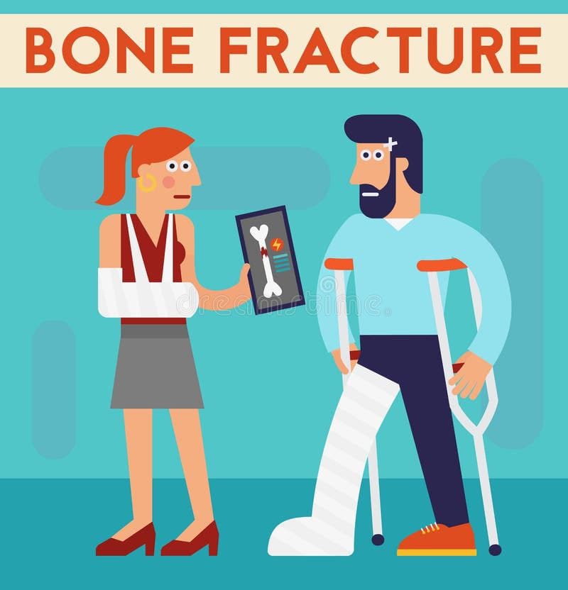 Post Fracture Physiotherapy